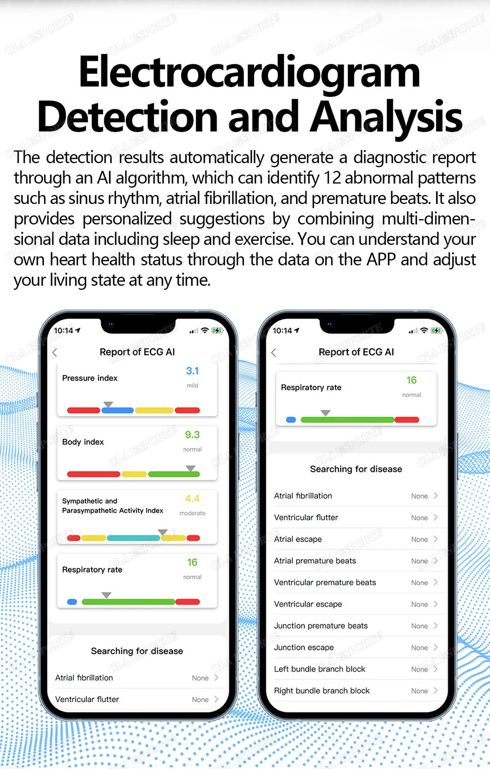 ECG Health Monitoring Smart Ring with Heart Rate &amp; SpO2