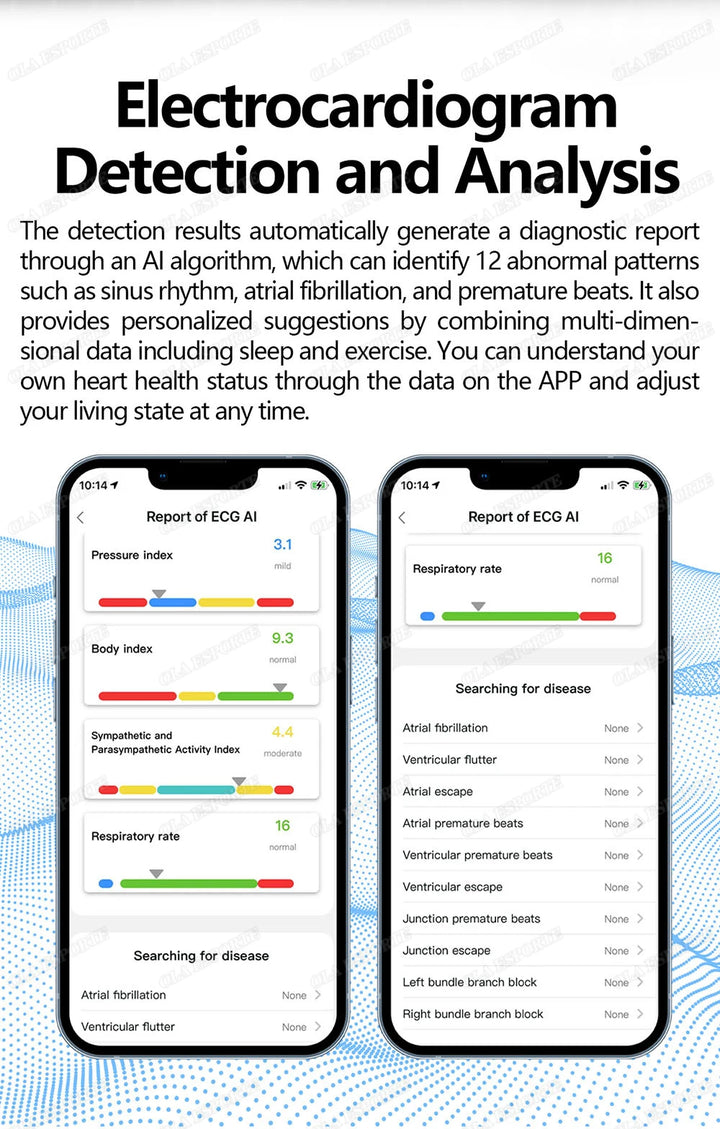 ECG Health Monitoring Smart Ring with Heart Rate &amp; SpO2